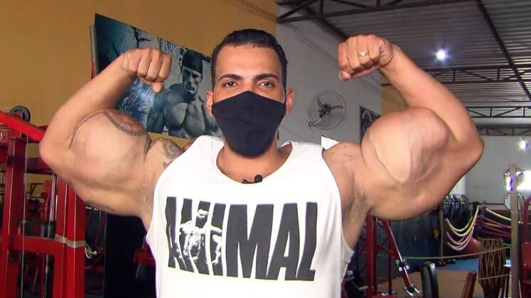 Câmera Record mostra as histórias de quem ultrapassou os limites para conseguir um corpo musculoso