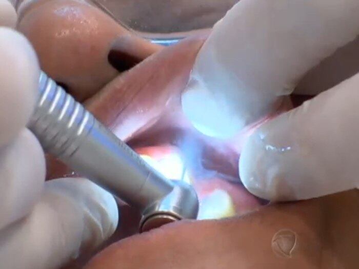 Ao cuidar da boca a pessoa está protegendo o corpo de doenças. As inflamações podem provocar diabetes, e o nascimento de crianças prematuras  

+ Veja entrevista completa com especialista em higiene bucal 

