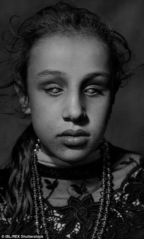 Além de mortos e
refugiados, a guerra na Síria rendeu, em quatro anos, milhares de órfãos,
crianças mutiladas, cegas, doentes, além de terríveis traumas psicológicos.

  


Os conflitos obrigaram
os pequenos a deixarem seus lares e seguir para campos de refugiados em países
vizinhos, onde vivem deitados em tendas, sofrendo com dores e esperando
tratamento médico.

 



Magnus Wennman,
fotógrafo sueco, passou por campos de refúgio e capturou algumas histórias comoventes,
onde milhares de crianças se abrigam por conta da guerra na Síria.

 



Muitas crianças
precisam de atendimento médico urgente. Elas apresentam cegueira, doenças
hepáticas, poliomielite e outras doenças frequentes. Muitos, se não todos, não
conseguem se lembrar da vida antes da guerra. Elas crescem sem educação, ou com
medos irracionais causadas pelos horrores da guerra.

 



Uma dessas vítimas é
Rahma, de 10 anos, que nasceu com uma deficiência visual. Na cidade síria de Dar’a,
a pequena frequentava uma escola especial. Ela conta que gostava da escola e se
sentia segura no local, mas após o início da guerra ela e sua família decidiram
deixar o país. Um hospital ofereceu uma cirurgia para Rahma. Mas a operação foi
um completo desastre e resultou na perda total da visão. “Eu nunca saio. Só
fico sentada dentro da tenda”, conta a refugiada.