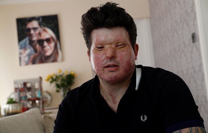 Para Christopheros, o Reino Unido adota uma estratégia completamente errada quando se trata desses tipos de ataque