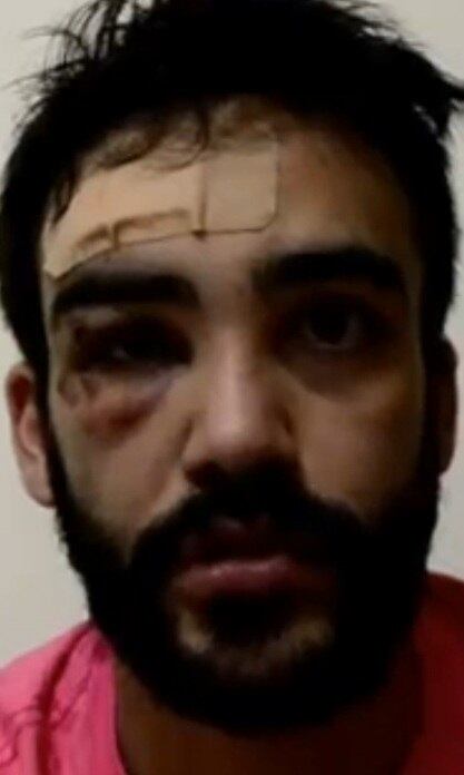 O estudante de direito, André Baliera, foi agredido na rua Henrique Schaumann