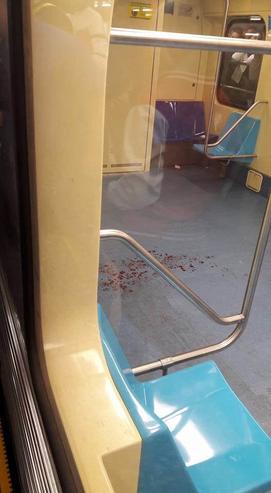 Jovem sofreu golpe no estômago