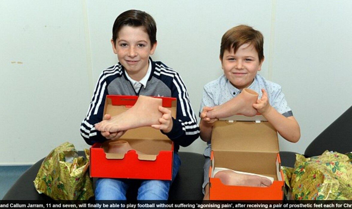 Dois irmãos amantes de futebol têm o que comemorar neste Natal. Ambos, que nasceram sem os dedos dos pés, só tinham um desejo: ganhar uma prótese para jogar uma partida