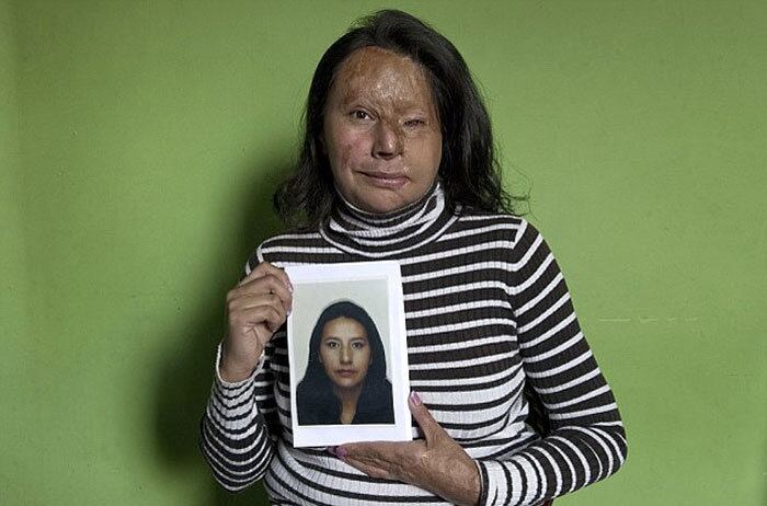 Na Colômbia, o crescimento do número de ataques com ácido contra mulheres colocou o país ao lado de Paquistão e Bangladesh no quesito violência doméstica. Nos primeiros meses de 2012, as estatísticas desse tipo de ataque no país já haviam superado o ano inteiro de 2011. Na imagem, a colombiana Maria Cuervo, vítima de ataque com ácido, mostra como era antes do ataque