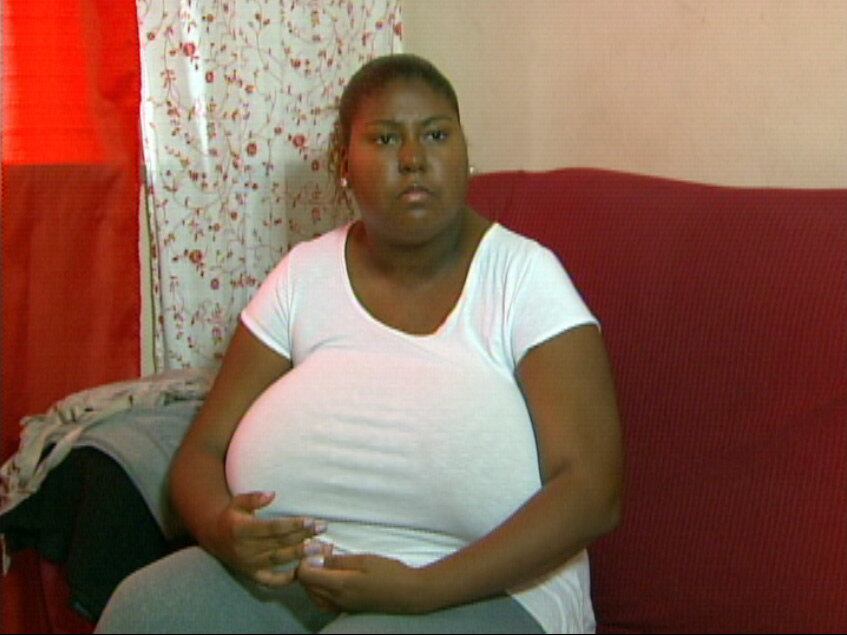 Há oito anos, Mayara luta para passar por uma cirurgia de
redução de seios. Aos 22 anos, a jovem moradora do Rio de Janeiro parou de
estudar por não aguentar mais o deboche dos colegas e também não pode trabalhar, devido às dores nas costas. Ela jamais conseguiu marcar a operação na
rede pública de saúde e teve o procedimento negado pelo plano de saúde, que
alega que não cobre tratamentos estéticos