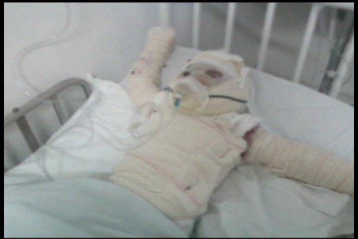 Pai foi queimar teia de aranha e faísca atingiu colchão em que menino dormia
