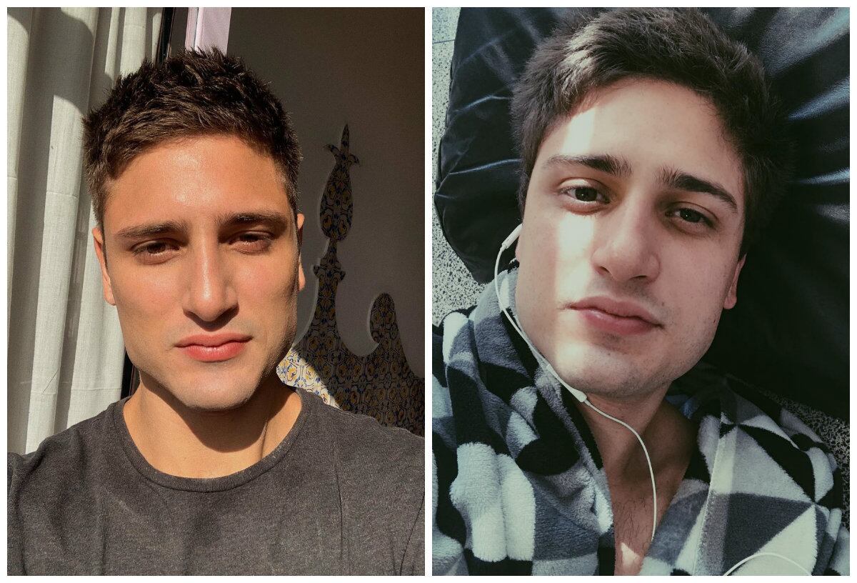 Procedimentos como a volumização da mandíbula, deixando o rosto mais quadrado, e a acentuação do queixo, são procedimentos comuns entre os homens, como é o caso do ator Daniel Rocha. Ele negou ter feito qualquer intervenção, mas a mudança no contorno facial é visível.  Yara explica que para acentuar o formato quadrado do rosto, é aplicado ácido hialurônico 