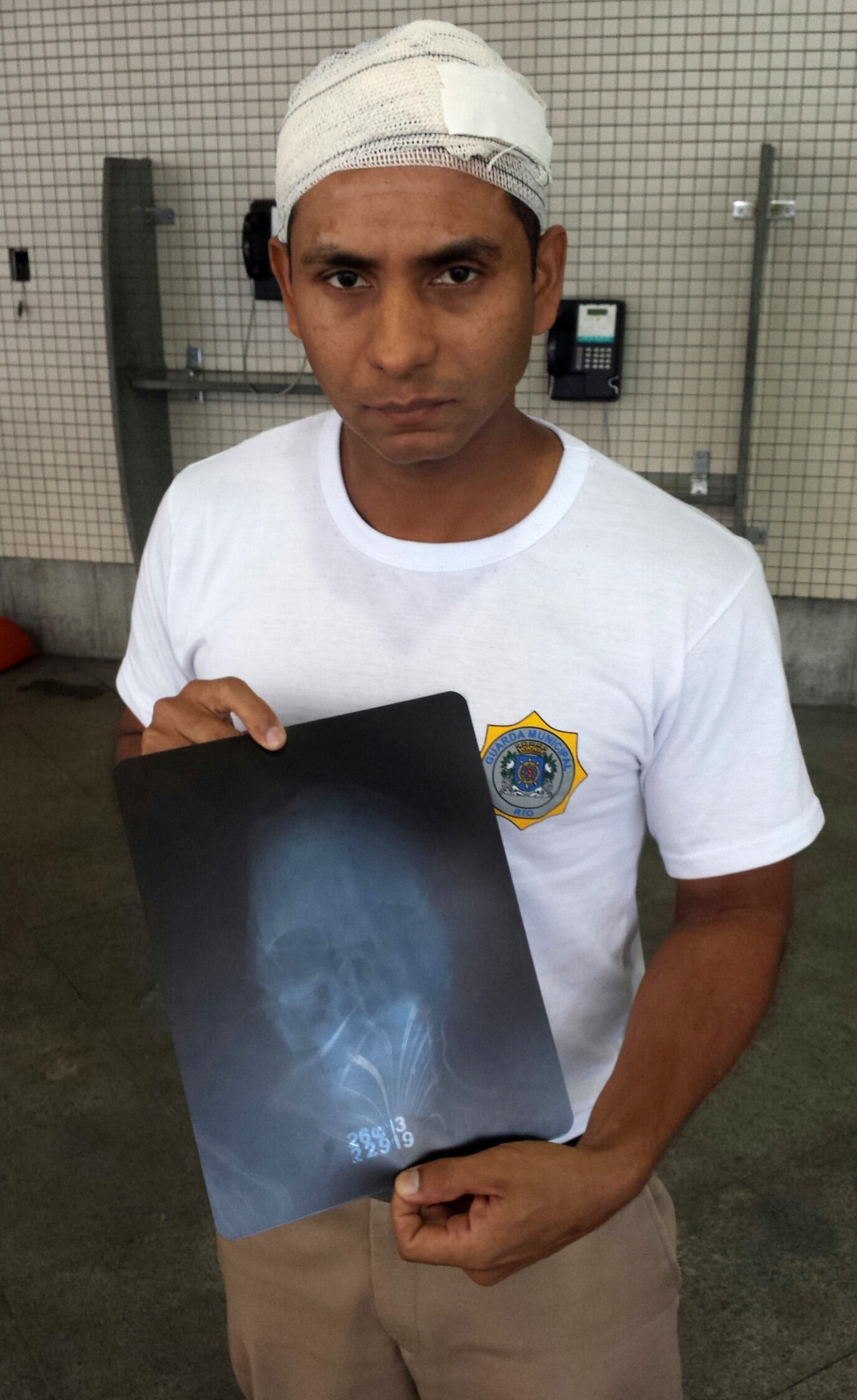 O guarda Sodré levou 5 pontos na cabeça