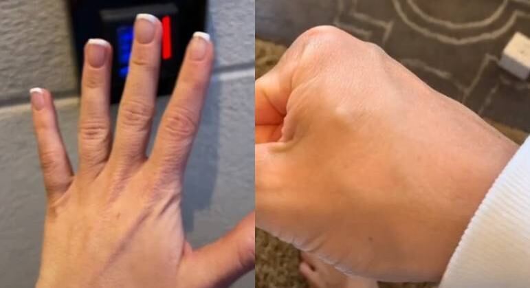 Os dois possuem o chip implantado na mão
