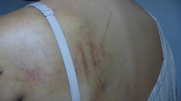 Na delegacia, a vítima disse não saber o que motivou as agressões, mas acredita que as agressoras têm inveja dela. A garota temeu pela própria vida. 

— [Elas falavam] que eu tinha tudo porque minha mãe me dava, e que as mães delas nem ligam para elas (sic). Quando elas deram a facada para eu cair na cova, eu tive certeza de que iria morrer
