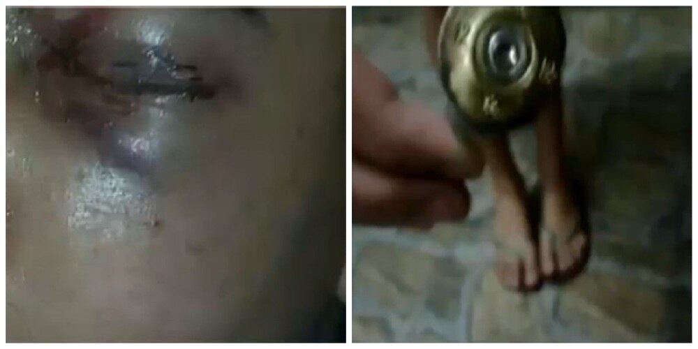 Adolescente de 15 anos perdeu a visão de um olho após ser atingido por
uma bala de borracha disparada por um policial militar na Brasilândia, zona
norte de São Paulo. Agora, ele e a família vivem com medo.

— Me sinto com tristeza porque não vou poder mais enxergar com um olho.
É difícil perder um olho com a minha idade