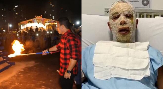 Prefeito de Osasco é vítima de explosão de fogueira em festa junina