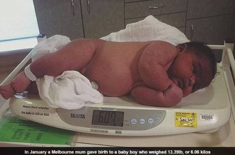 Os pais do menino, que não quiserem
ser identificados, disseram que não eram altos se chocaram com o tamanho do
bebê.


— Nós não somos tão altos. Então não
temos certeza de onde vem esse tamanho todo.

Na foto, outro bebê grande nascido na Austrália em janeiro