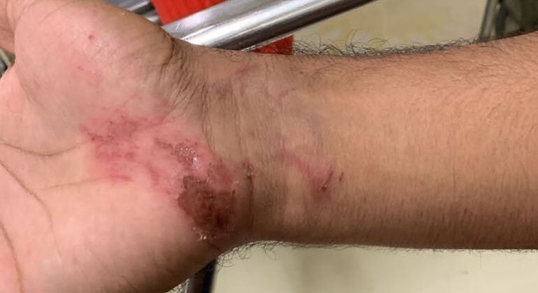 Casal precisou ser levado para hospital