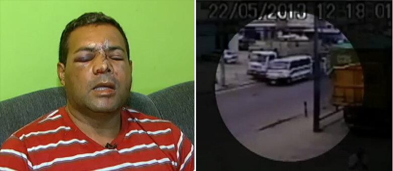 Vítima ficou com hematomas graves no rosto; circuito de monitoramento registrou atropelamento