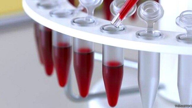 Tipo sanguíneo pode mostrar risco de se desenvolver doenças cognitivas