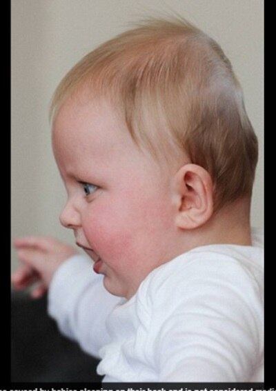 A jovem Kate Roberts,
de 24 anos, conseguiu arrecadar cerca de R$ 10 mil em apenas um dia para
comprar um capacete especial para seu filho, Miles, que foi diagnosticado com
síndrome da cabeça chata