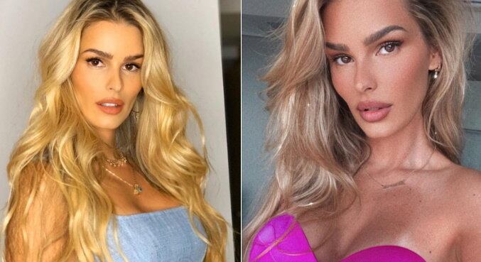 Yasmin Brunet
A modelo e empresária recebia sempre a mesma pergunta dos seguidores nas redes sociais: se ela tinha retirado uma costela para afinar a silhueta. Yasmin desmentiu o boato: "Nunca! As pessoas fazem isso na real?". No rosto, a influenciadora nega intervenções muito invasivas, como bichectomia e harmonização, mas revelou que aplica Botox: "Faço Botox bem leve para ficar 'forever' 20, 33 anos, né, gente?", explicou ela usando o termo em inglês, que significa "para sempre"