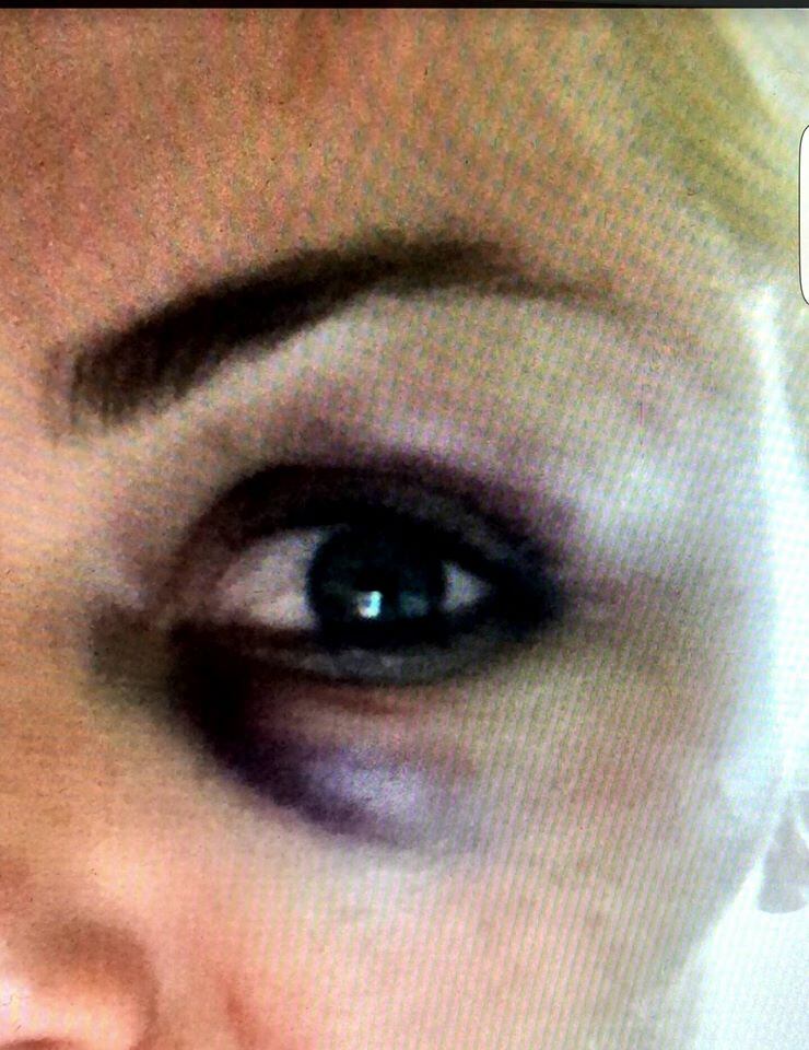 Segundo a PF, Bertoldi é acusado
de violência doméstica, lesões corporais, constrangimento ilegal, trabalho
escravo, ameaça por palavras e estupro da ex-noiva Tatiane Bittencourt. A prisão preventiva do ex-parlamentar
foi decretada em janeiro porque ele teria violado a Lei Maria da Penha ao se
aproximar de sua vítima